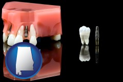 alabama map icon and a titanium dental implant and wisdom tooth