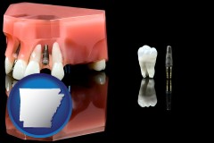 arkansas map icon and a titanium dental implant and wisdom tooth