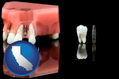 california map icon and a titanium dental implant and wisdom tooth