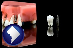 washington-dc map icon and a titanium dental implant and wisdom tooth