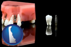 delaware map icon and a titanium dental implant and wisdom tooth