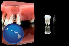 hawaii map icon and a titanium dental implant and wisdom tooth