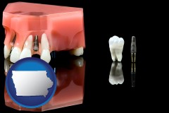 iowa map icon and a titanium dental implant and wisdom tooth