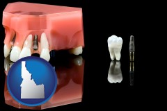 idaho map icon and a titanium dental implant and wisdom tooth