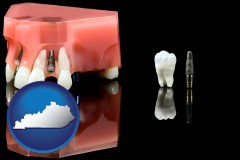 kentucky map icon and a titanium dental implant and wisdom tooth
