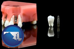 maryland map icon and a titanium dental implant and wisdom tooth