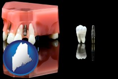 maine map icon and a titanium dental implant and wisdom tooth