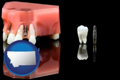 montana map icon and a titanium dental implant and wisdom tooth