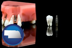 nebraska map icon and a titanium dental implant and wisdom tooth