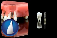new-hampshire map icon and a titanium dental implant and wisdom tooth
