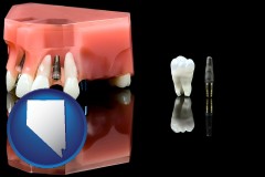 nevada map icon and a titanium dental implant and wisdom tooth
