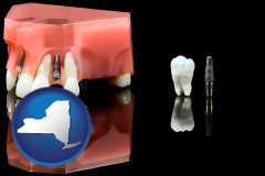 new-york map icon and a titanium dental implant and wisdom tooth