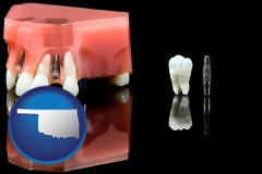 oklahoma map icon and a titanium dental implant and wisdom tooth