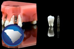 south-carolina map icon and a titanium dental implant and wisdom tooth