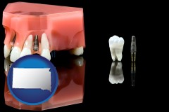 south-dakota map icon and a titanium dental implant and wisdom tooth