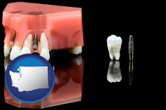 washington map icon and a titanium dental implant and wisdom tooth