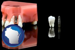 wisconsin map icon and a titanium dental implant and wisdom tooth