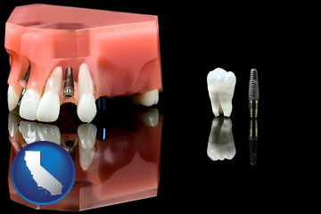 a titanium dental implant and wisdom tooth - with California icon