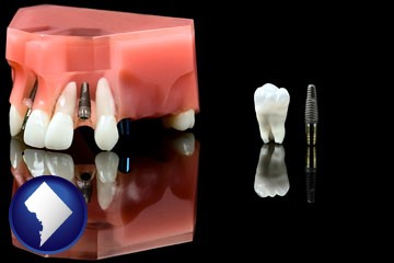 a titanium dental implant and wisdom tooth - with Washington, DC icon