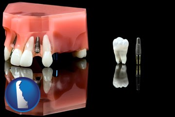 a titanium dental implant and wisdom tooth - with Delaware icon