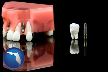 a titanium dental implant and wisdom tooth - with Florida icon