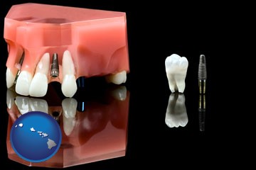 a titanium dental implant and wisdom tooth - with Hawaii icon