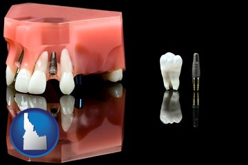 a titanium dental implant and wisdom tooth - with Idaho icon