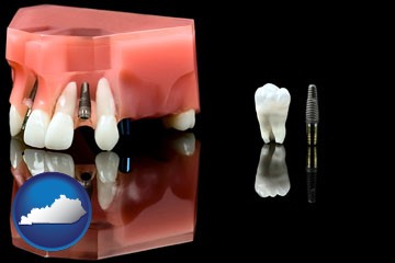 a titanium dental implant and wisdom tooth - with Kentucky icon