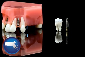a titanium dental implant and wisdom tooth - with Massachusetts icon