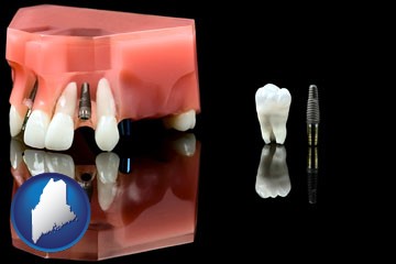 a titanium dental implant and wisdom tooth - with Maine icon