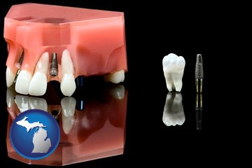 a titanium dental implant and wisdom tooth - with Michigan icon