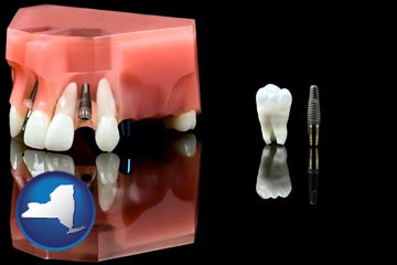 a titanium dental implant and wisdom tooth - with New York icon