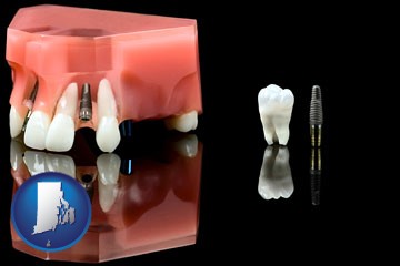 a titanium dental implant and wisdom tooth - with Rhode Island icon