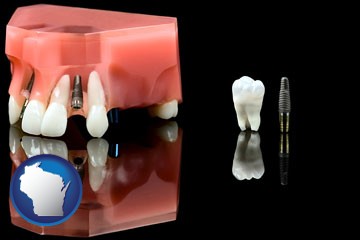 a titanium dental implant and wisdom tooth - with Wisconsin icon