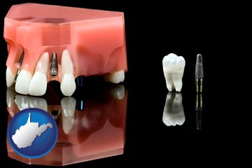 a titanium dental implant and wisdom tooth - with West Virginia icon